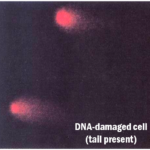 VeinLite Ischemia Banner 3