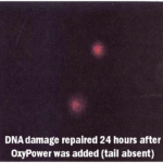 VeinLite Ischemia Banner 4